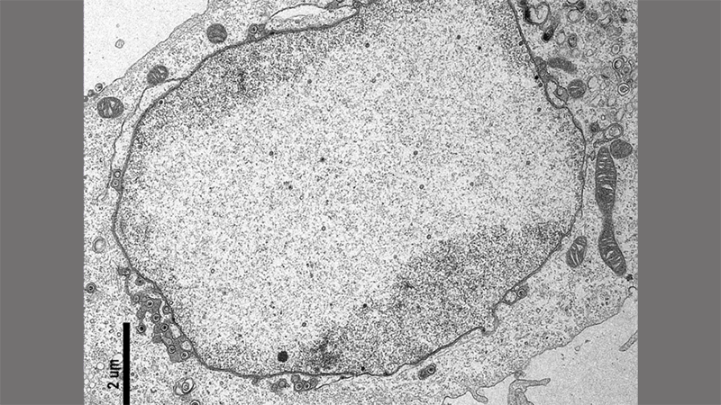 Cell infected with herpes simplex virus type 1. Image captured by the author in the Center for Advanced Microscopy core facility at Northwestern University Feinberg School of Medicine. The black scale bar is 2 micrometers (um) long which is 250 times smaller than a grain of salt. (Photo credit: Laura Ruhge).