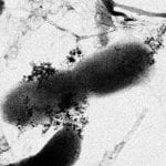E Coli bacteria surrounded by a cluster of titanium oxide and silver nanoparticles.